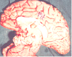 brain-31.gif 