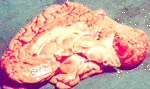 brain-32.gif 