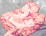 brain-33.gif (16031 bytes)