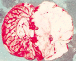 brain-34.gif 