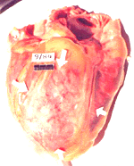 heart-1.gif