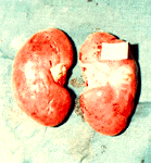 kidney1.gif