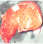 liver-23.gif