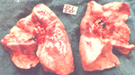 lungs3.gif